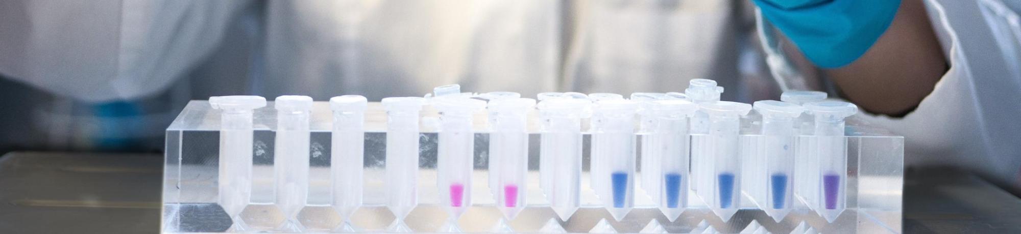 Photo of scientist pipetting colored liquid into vials, by Julia Koblitz on Unsplash